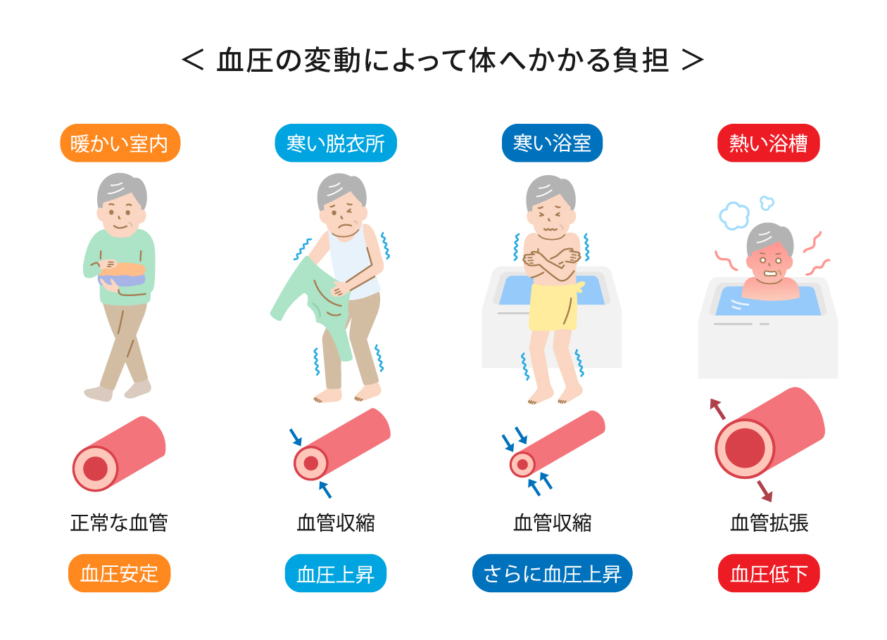 血圧の変動によって体へかかる負担 